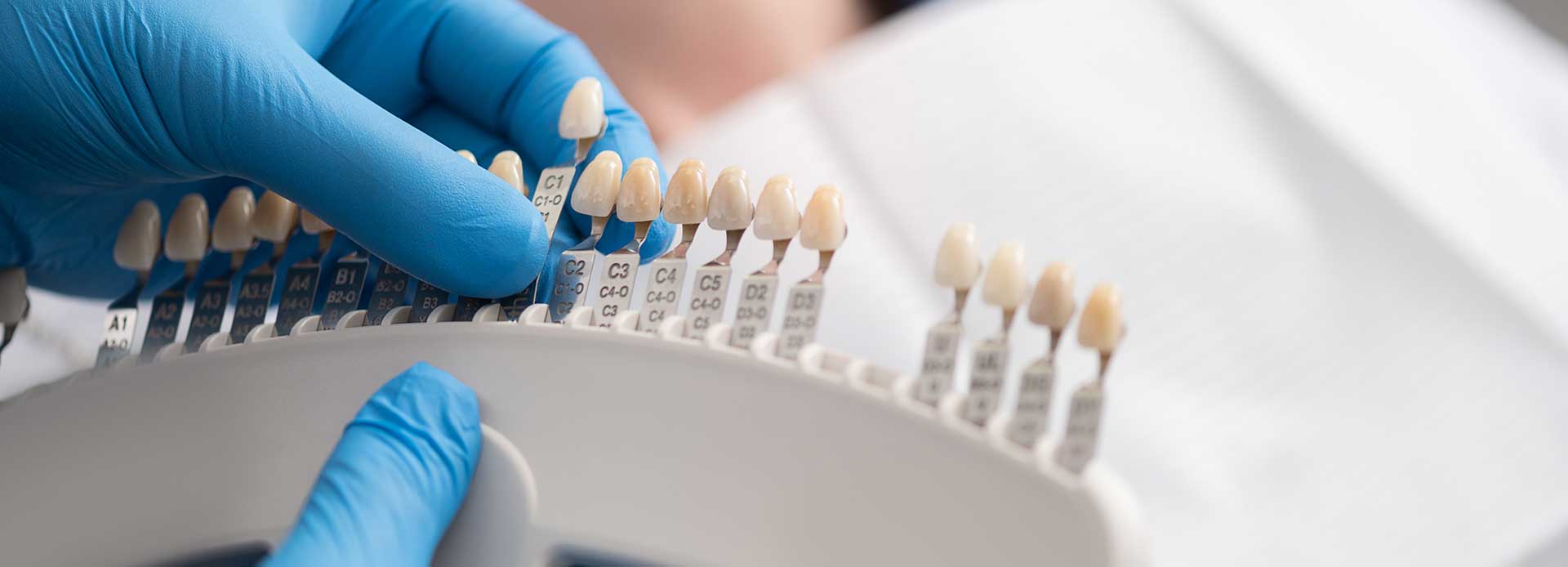 A dental staff picking a dental crown amongst different sizes