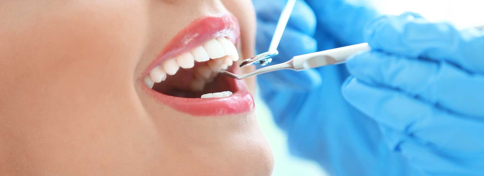 A woman getting filling treatment at the dentist